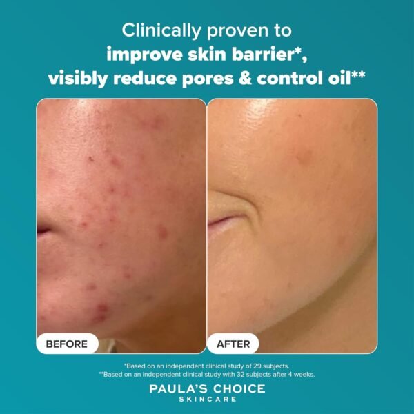 paula’s choice 2% bha liquid exfoliant 118ml